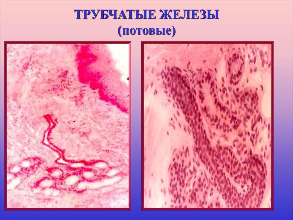 Простые трубчатые. Потовые железы кожи гистология. Потовые железы микропрепарат. Эпителий потовых желёз\. Простая трубчатая неразветвленная потовая железа.