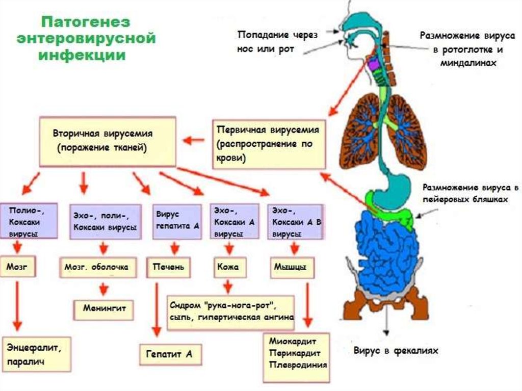 Энтеровирусная инфекция у детей презентация