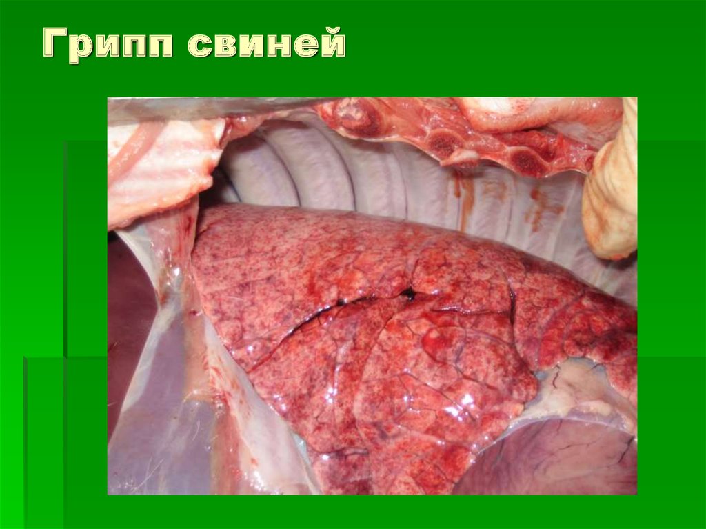 Грипп свиней