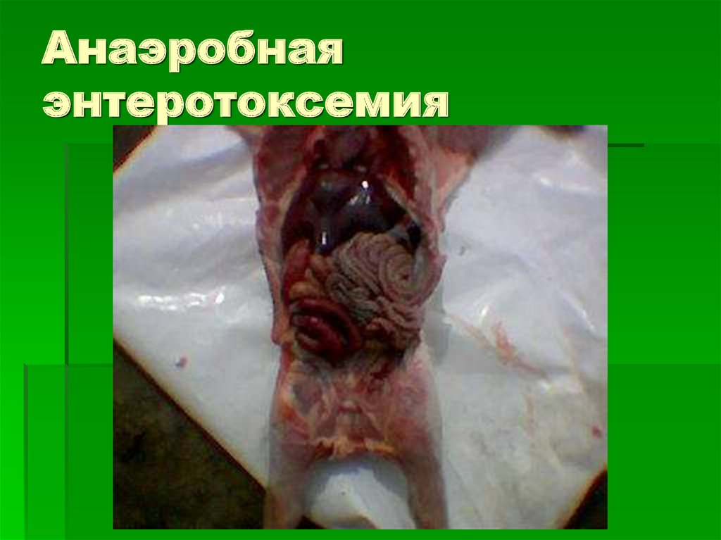 Анаэробная энтеротоксемия