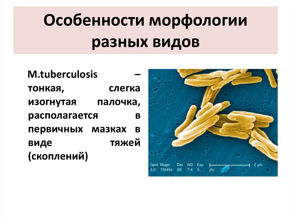 Человеческая морфология