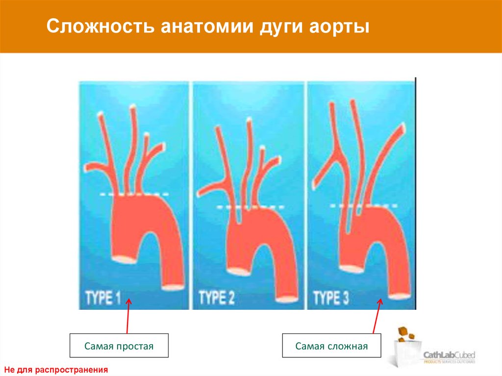 Ветви и дуги аорты схема