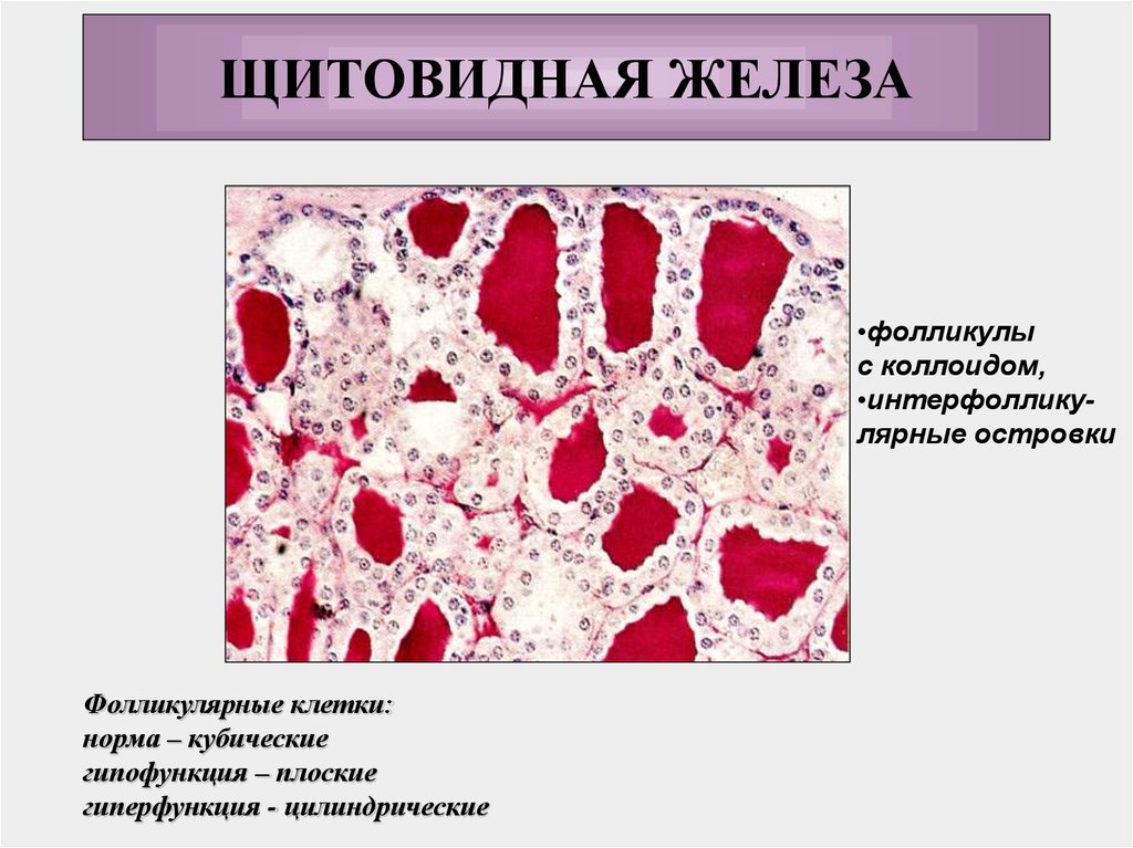 Фолликулярные железы. Щитовидная железа гистология интерфолликулярный островок. Интерфолликулярные островки щитовидная железа препарат. Интерфолликулярные клетки щитовидной железы. Эндокринные клетки щитовидной железы.