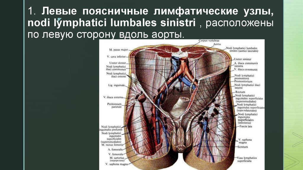 1 левой. Поясничные лимфатические узлы - Nodi lymphatici lumbales. Лимфатический узел Пирогова-Розенмюллера. Поясничные лимфоузлы анатомия. Забрюшинные лимфатические узлы.