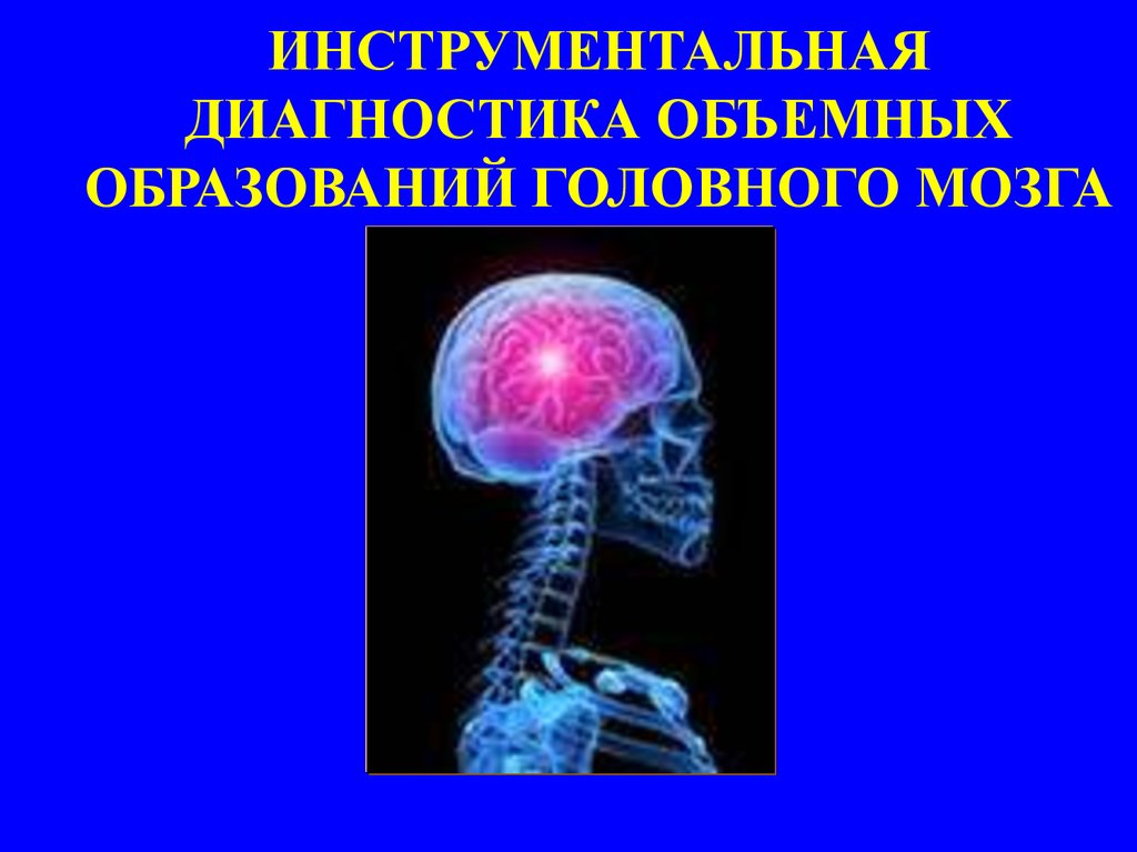 Образование головного мозга. Инструментальная диагностика опухолей головного мозга. Образования головного мозга. Основной метод диагностики опухоли головного мозга. Инструментальные методы диагностики опухолей мозга.