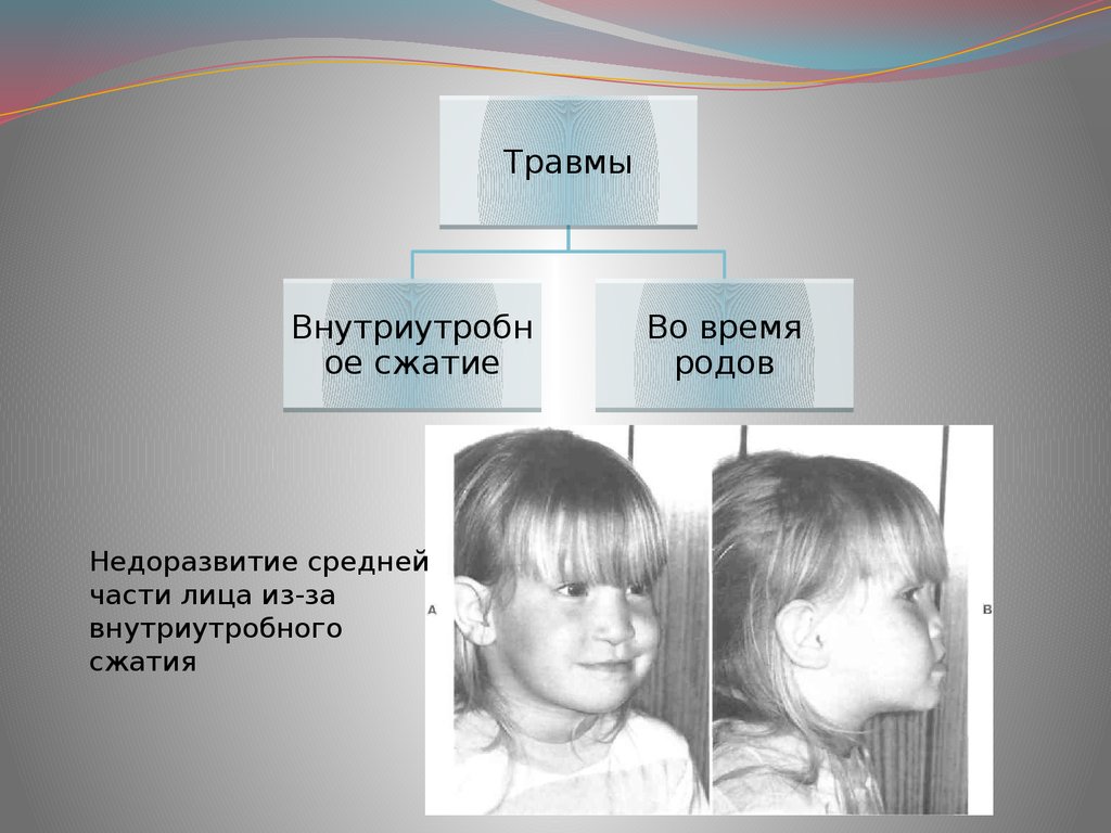 Недоразвитие нарушение. Недоразвитие эмоция это. Полное недоразвитие молочных.