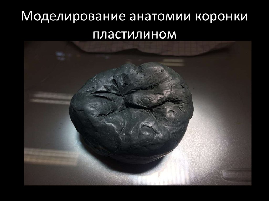 Моделирование анатомии коронки пластилином