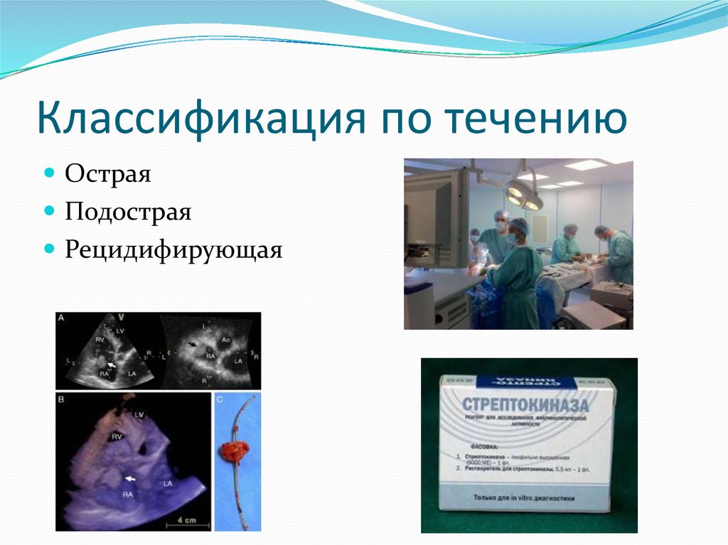 Классификация по течению