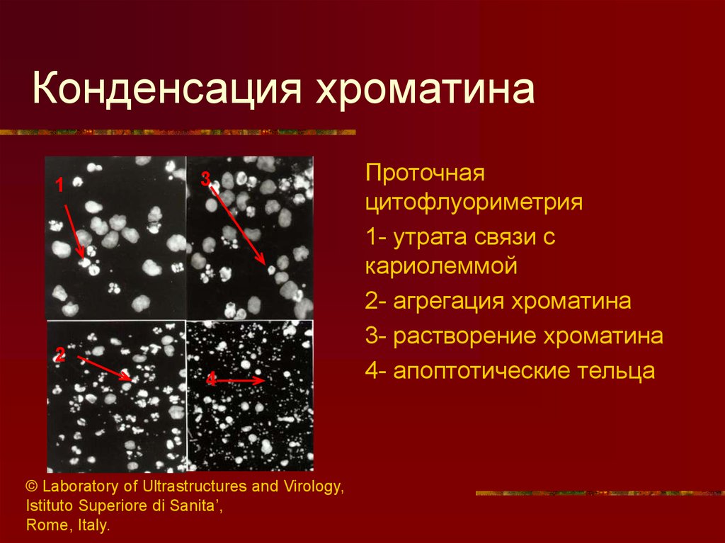 Конденсируется это. Конденсация хроматидп. Конденсация и деконденсация хроматина. Конденсирование хроматина. Хроматин конденсируется.