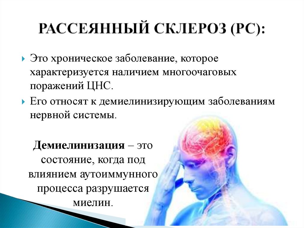 Рассеянный склероз неврология презентация