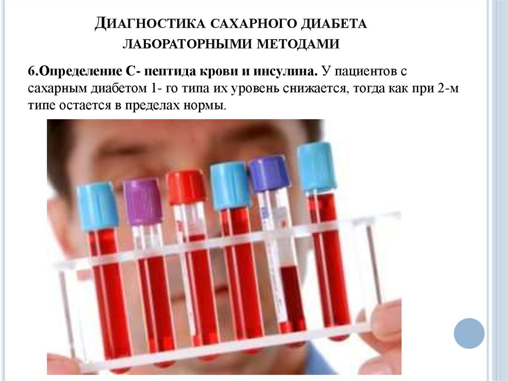 Диагностика сахарного диабета презентация