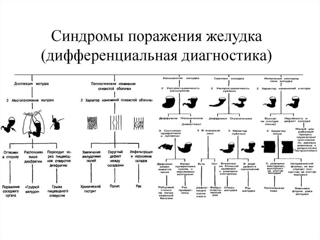 Синдром желудка. Рентгенологические синдромы патологии ЖКТ. Алгоритм дифференциальной рентгенодиагностики болезней. Алгоритм дифференциальной диагностики рентгенодиагностики. Алгоритм дифференциальной диагностики заболеваний пищевода.