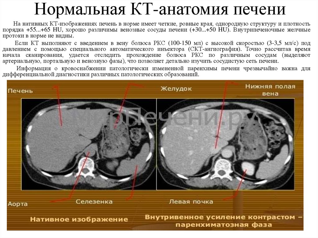 Кт анатомия печени