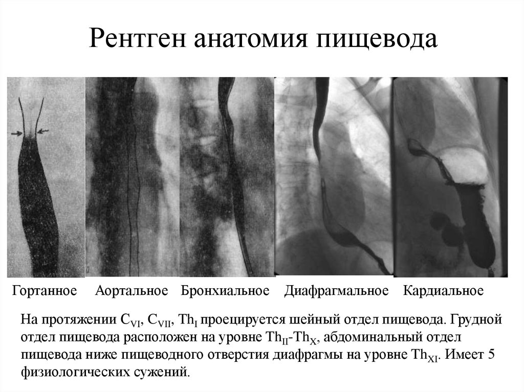 Рентген анатомия пищевода