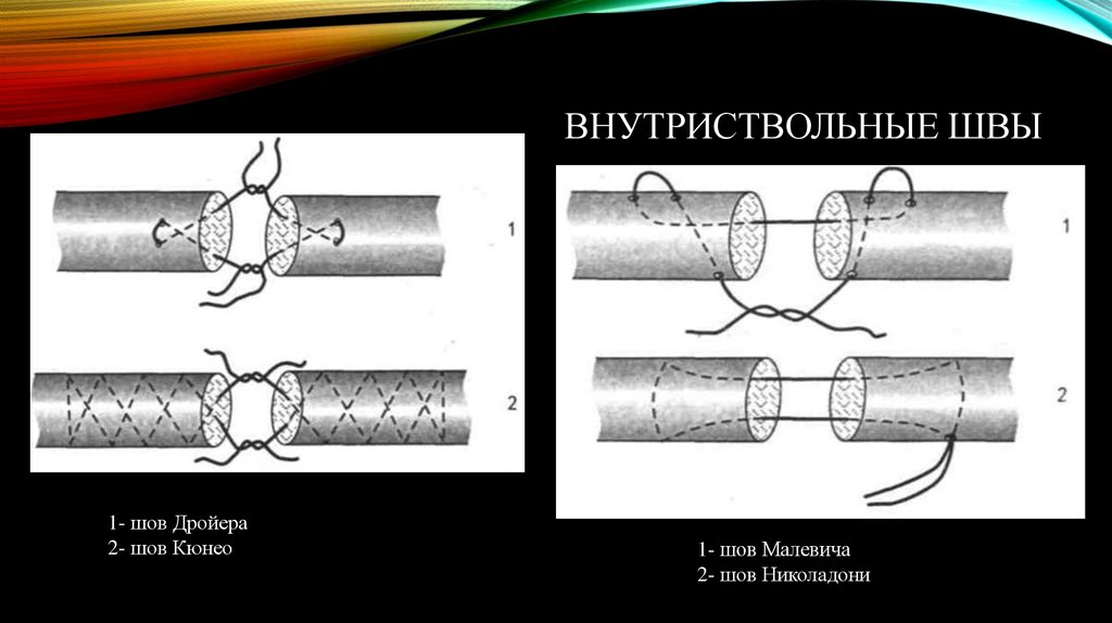 Стыки 1 глава