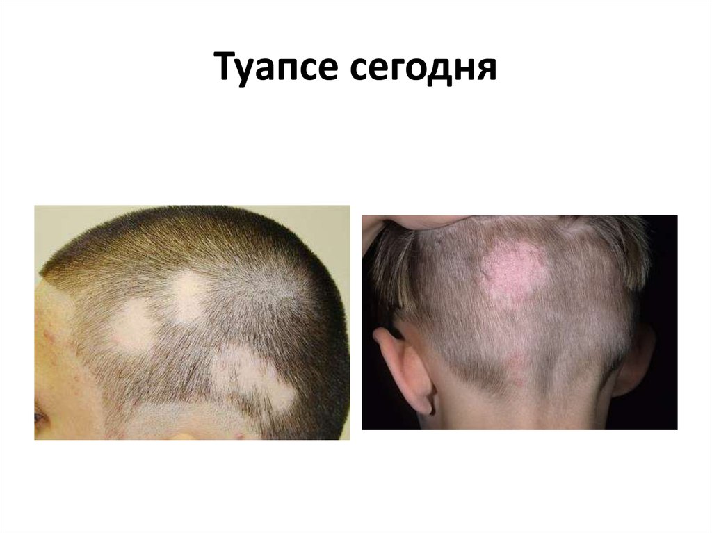 Туапсе сегодня