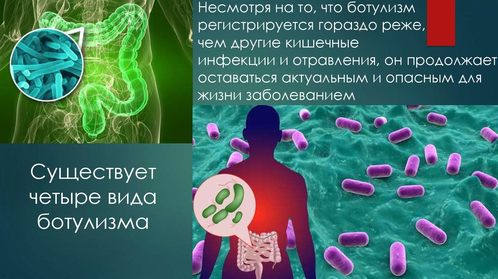 Часто приводит к возникновению ботулизма. Ботулизм зооантропоноз. Кишечные инфекции ботулизм. Возбудители бактериальных кишечных инфекций ботулизма. Ботулизм презентация инфекционные болезни.