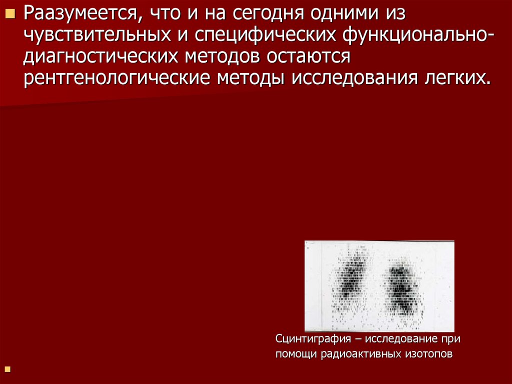 Методы диагностики заболеваний легких. Синдром плюс ткань рентгенологические методы диагностики. Метод диагностики микроделеционнызисиндрома. PN-метод Шимуковича.