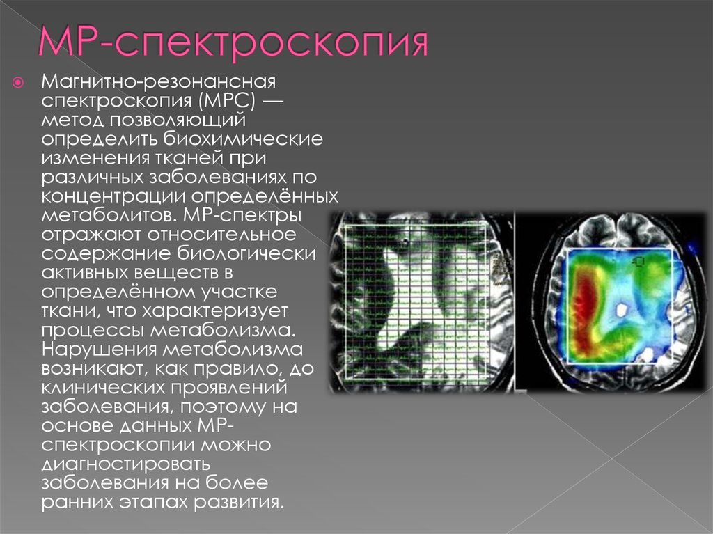 Магнитно резонансная томография презентация