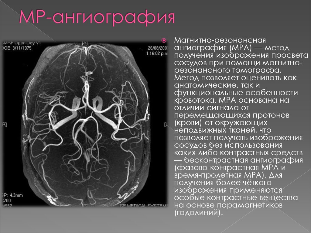 Функциональная мрт презентация