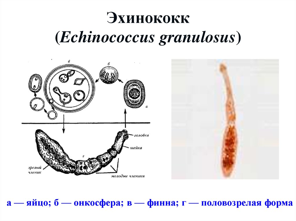 Онкосфера в кишечнике. Онкосфера эхинококка. Онкосфера ленточных червей. Эхинококкоз строение.