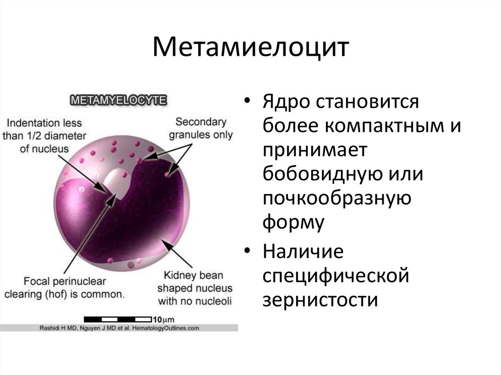 Определение темного ядра. Миелоцит метамиелоцит. Миелоциты и метамиелоциты. Миелоциты промиелоциты метамиелоциты. Миелоциты и метамиелоциты в крови.