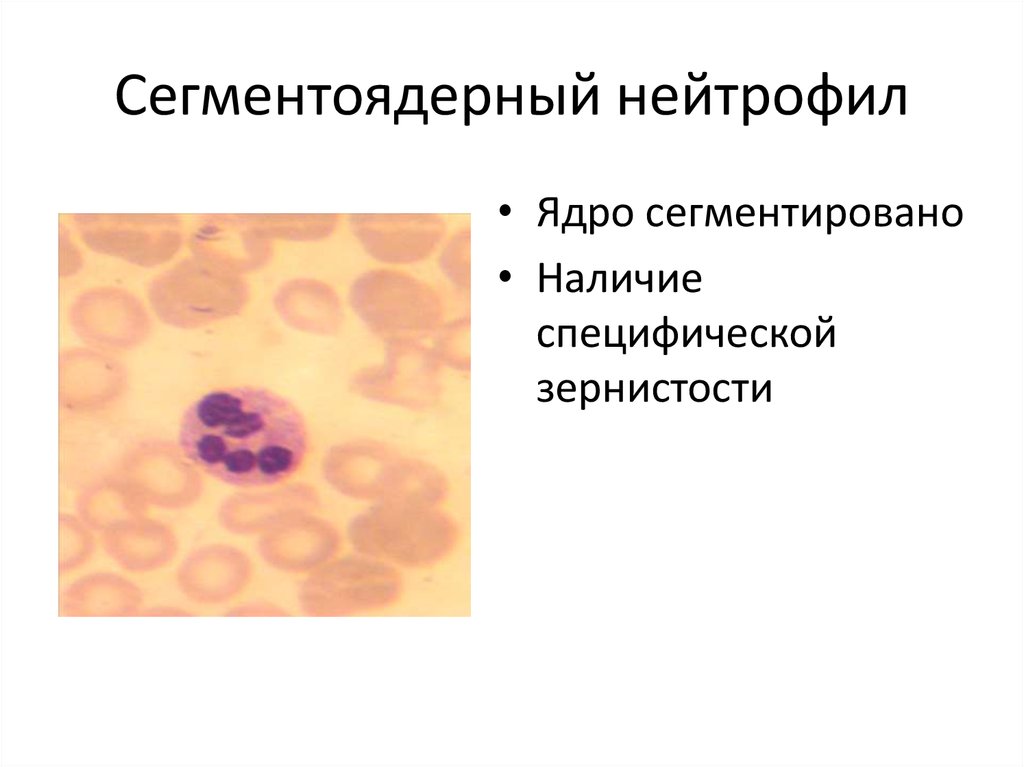 Понижены сегментоядерные нейтрофилы в крови у женщин. Сегментоядерные нейтрофилы под микроскопом. Сегментоядерный нейтрофил гистология. Палочкоядерный и сегментоядерный нейтрофил.