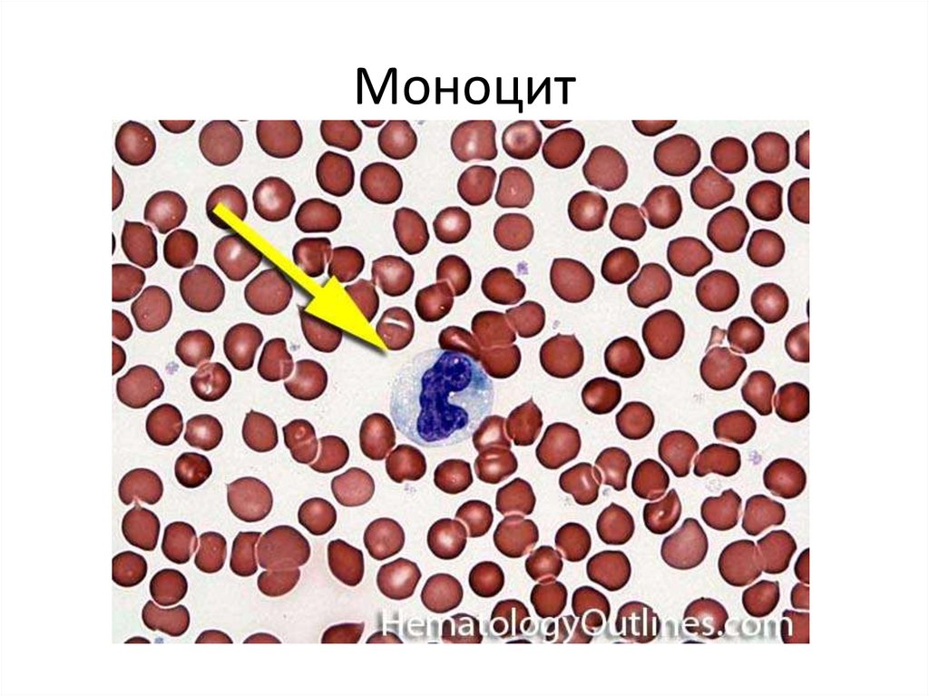 Презентации по гематологии