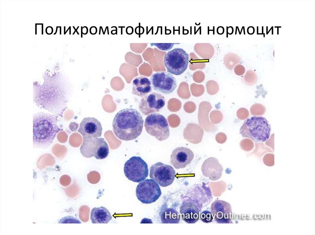 Нормоциты фото под микроскопом