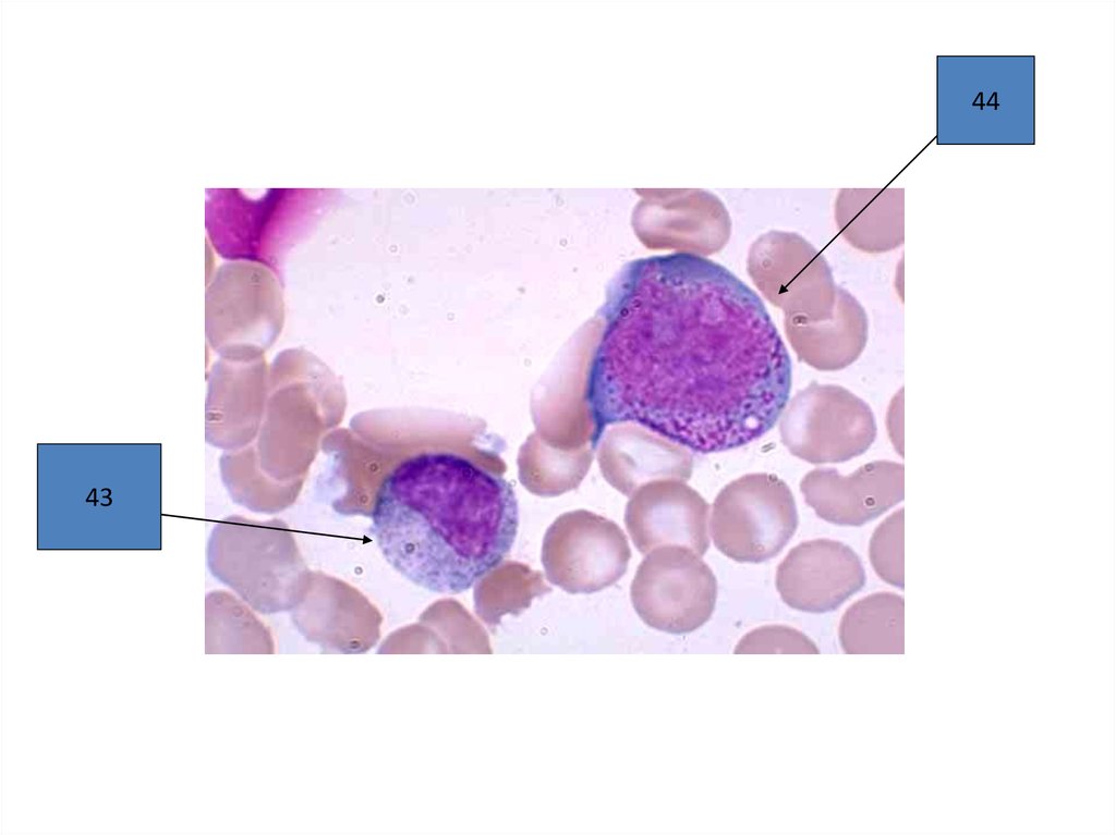 Практическая гематология. Гематология презентация. Гематология рыб презентация. Диелент гематология. Тельца Курлова гематология.
