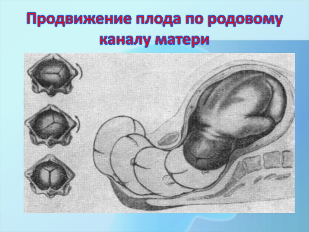 Прохождение через родовой путь. Продвижение плода по родовому каналу. Продвижение головки по родовому каналу. Продвижение головки плода по родовому каналу. Движение ребенка по родовым путям.