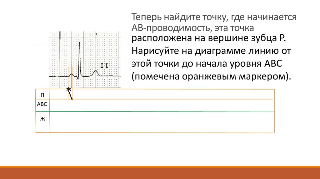 Теперь искать. Лестничная диаграмма ЭКГ. Пунктир на графиках откуда начинается. Объяснение лестничной диаграммы. На графике точки линия разделяют эти точки.