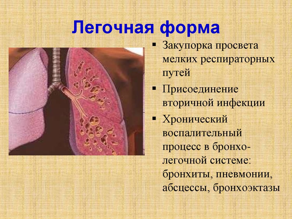 Кистозный фиброз презентация