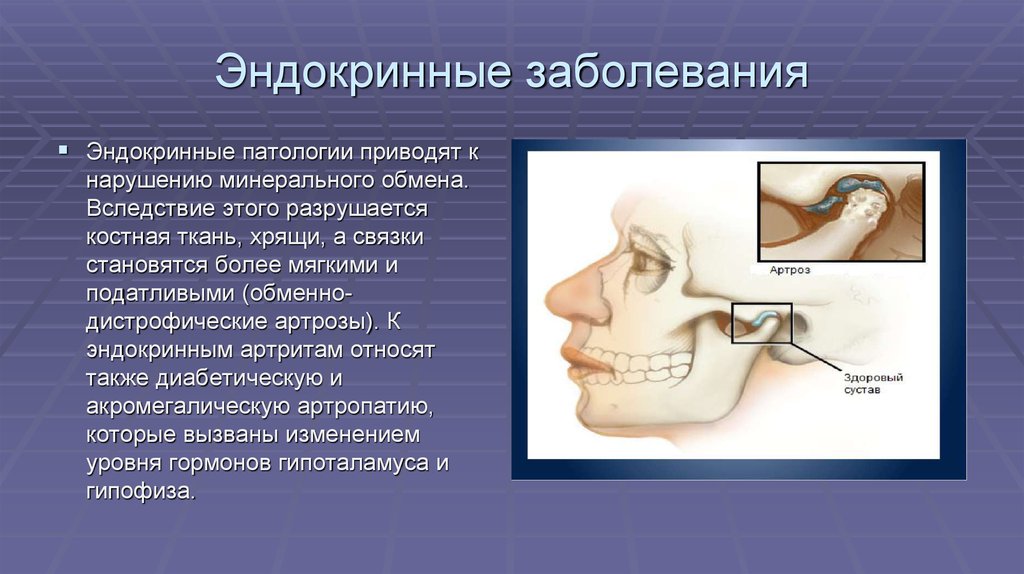 Заболевания эндокринной системы. При эндокринных заболеваниях характерно лицо. Заболеваемость эндокринной патологией.