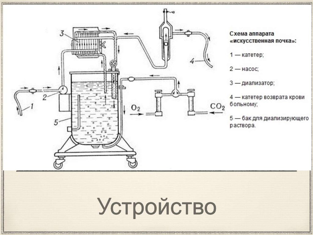 Схема аппарата. Схема Советской модели аппарата «искусственная почка». Аппарат для гемодиализа схема аппарата. Аппарат 