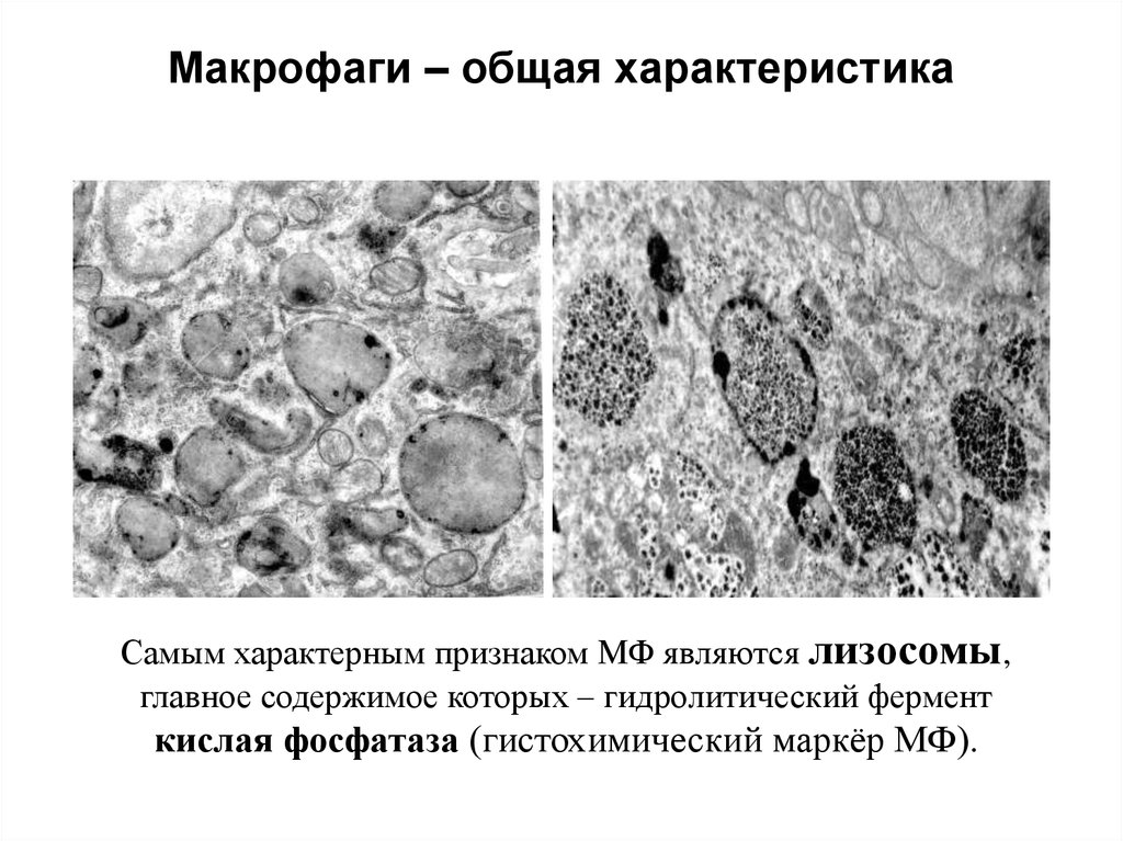 Наиболее характерным признаком. Макрофаги гистология строение. Макрофаги функции гистология. Тканевой Макрофаг характеристика. Макрофаги характеристика.