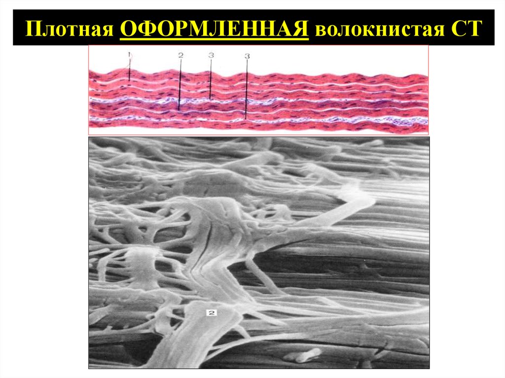Сухожилия ткань. Плотная волокнистая оформленная. Сухожилие под микроскопом. Пучок эластических волокон.