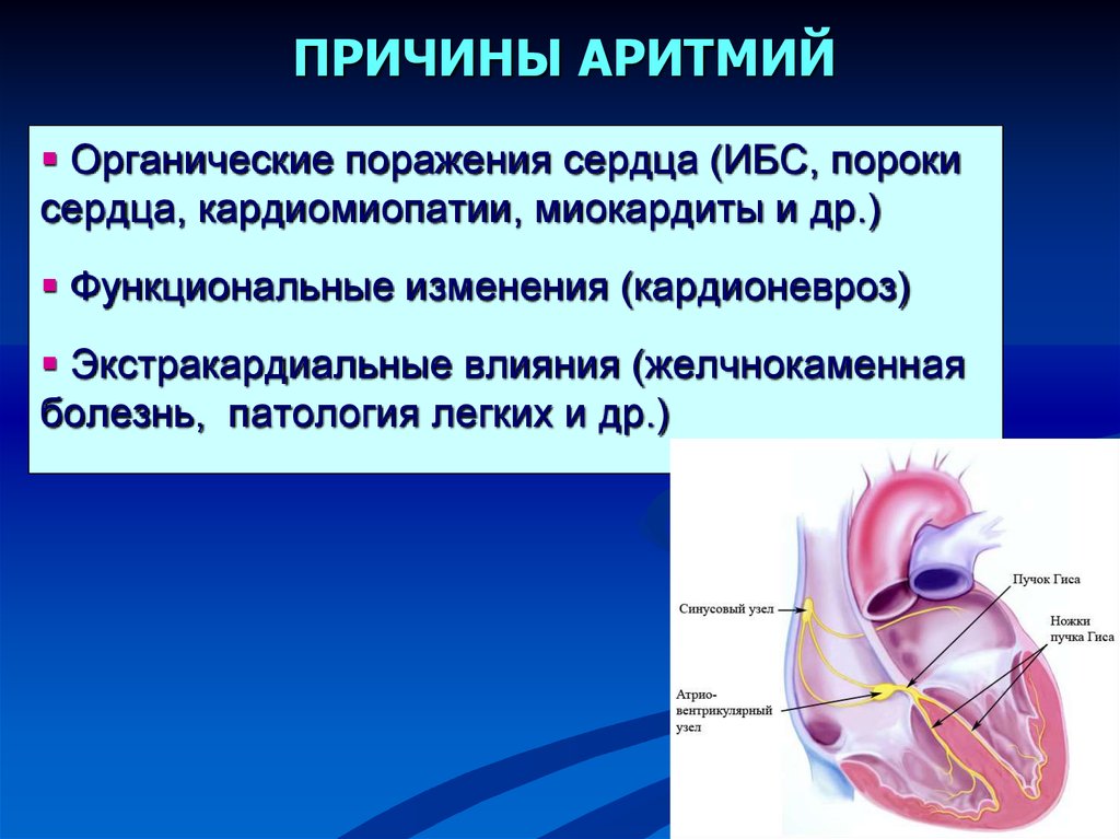 Аритмия причины. Органические поражения сердца. Функциональные пороки сердца. Органические пороки сердца. Функциональные изменения сердца.