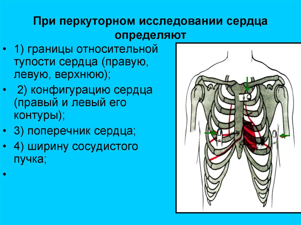 Нормальная конфигурация сердца рисунок