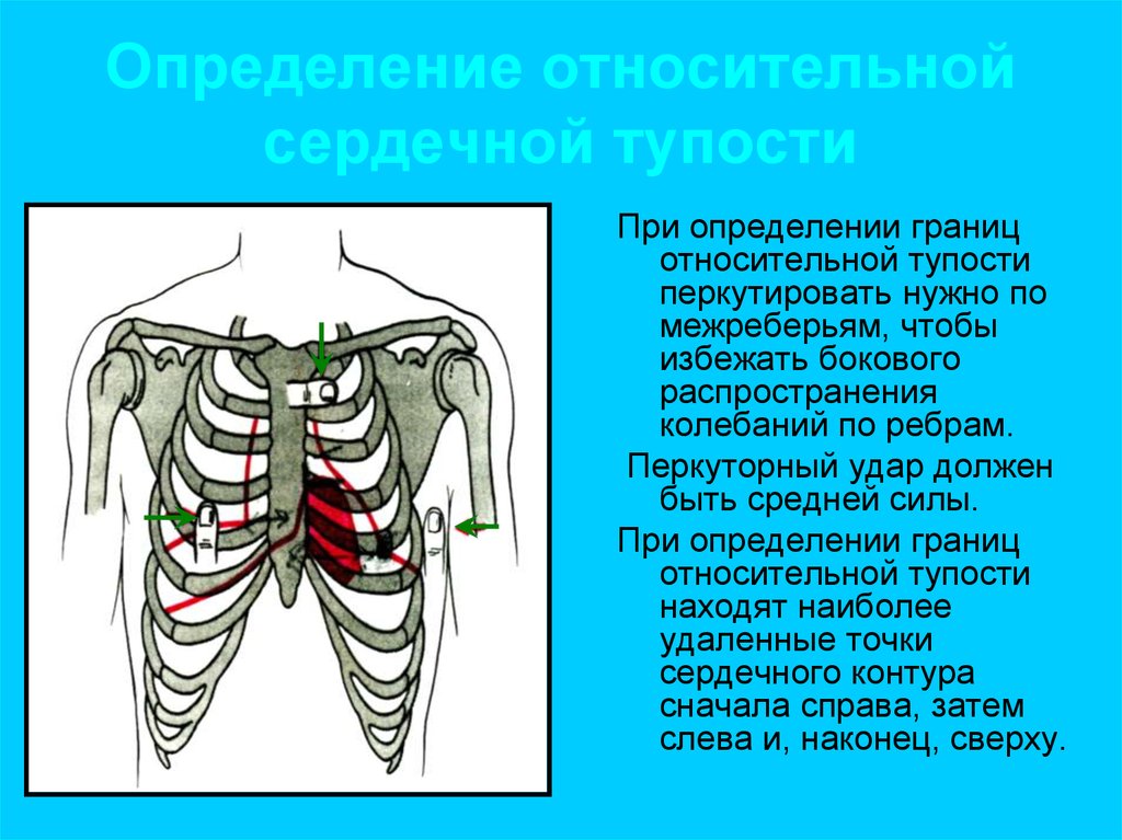 Определение границ сердечной тупости