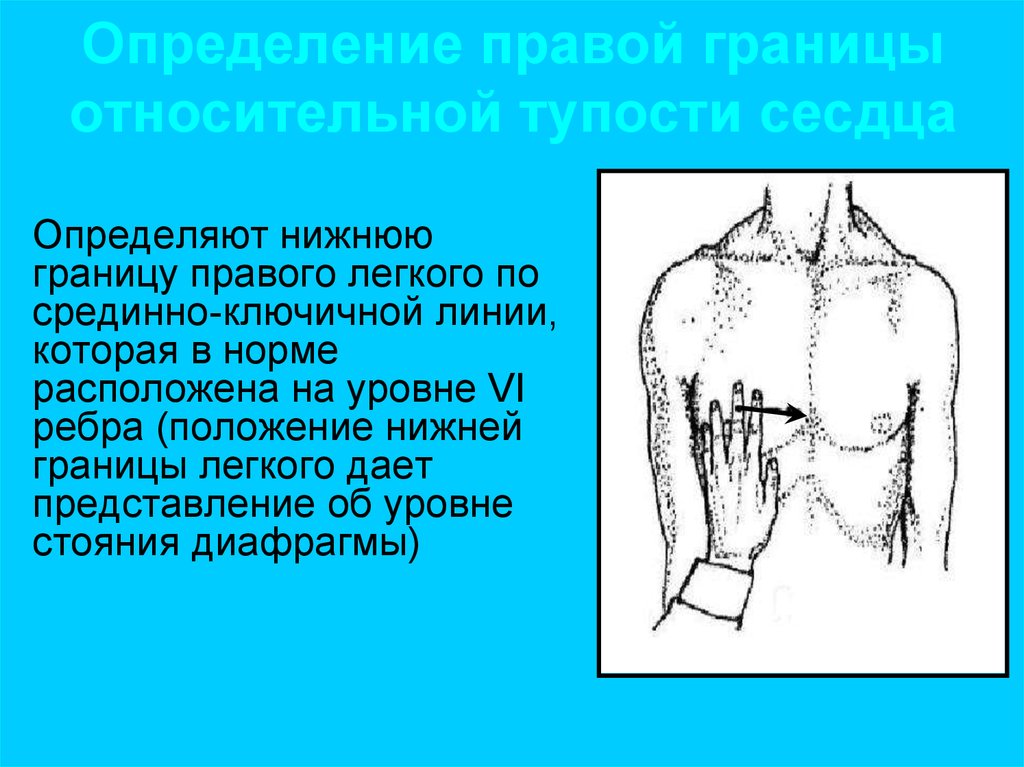 Поперечник относительной тупости сердца