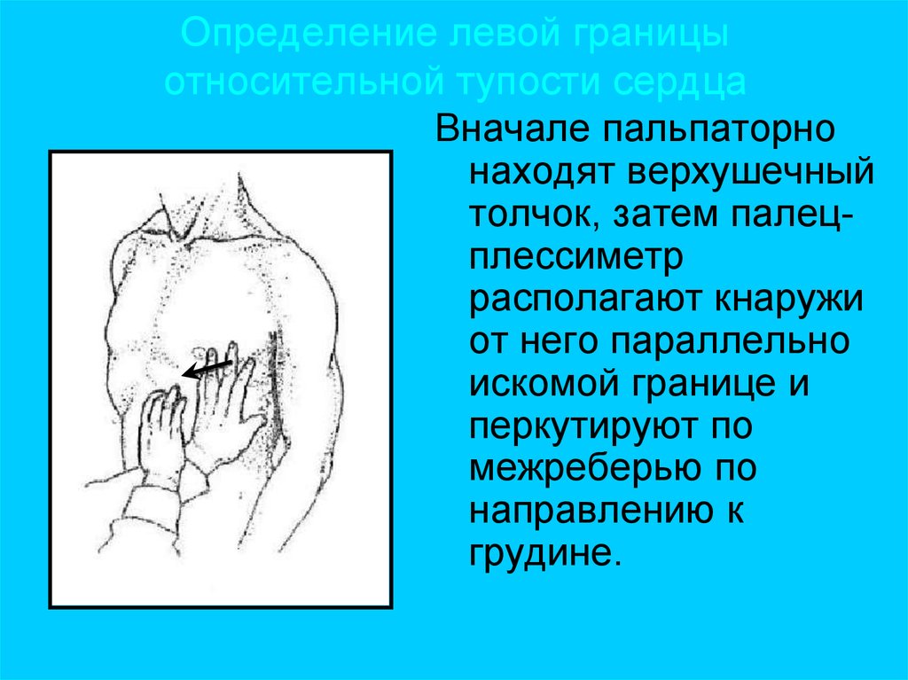 Верхняя граница относительной. Перкуссия абсолютной тупости сердца. Границы относительной сердечной тупости сердца. Левая граница сердца перкуссия.