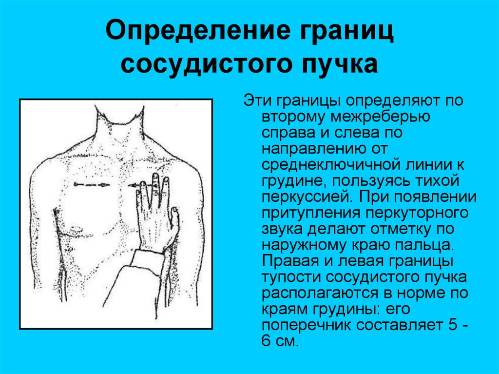 Усиление портального сосудистого рисунка печени у ребенка