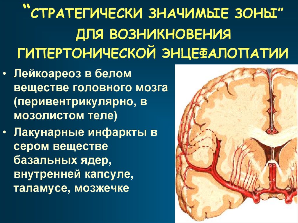 Очаги ишемии головного мозга. Зоны ишемии головного мозга. Ишемический инфаркт мозжечка. Ишемический инфаркт мозжечка кт. Инфаркт мозжечка мрт.