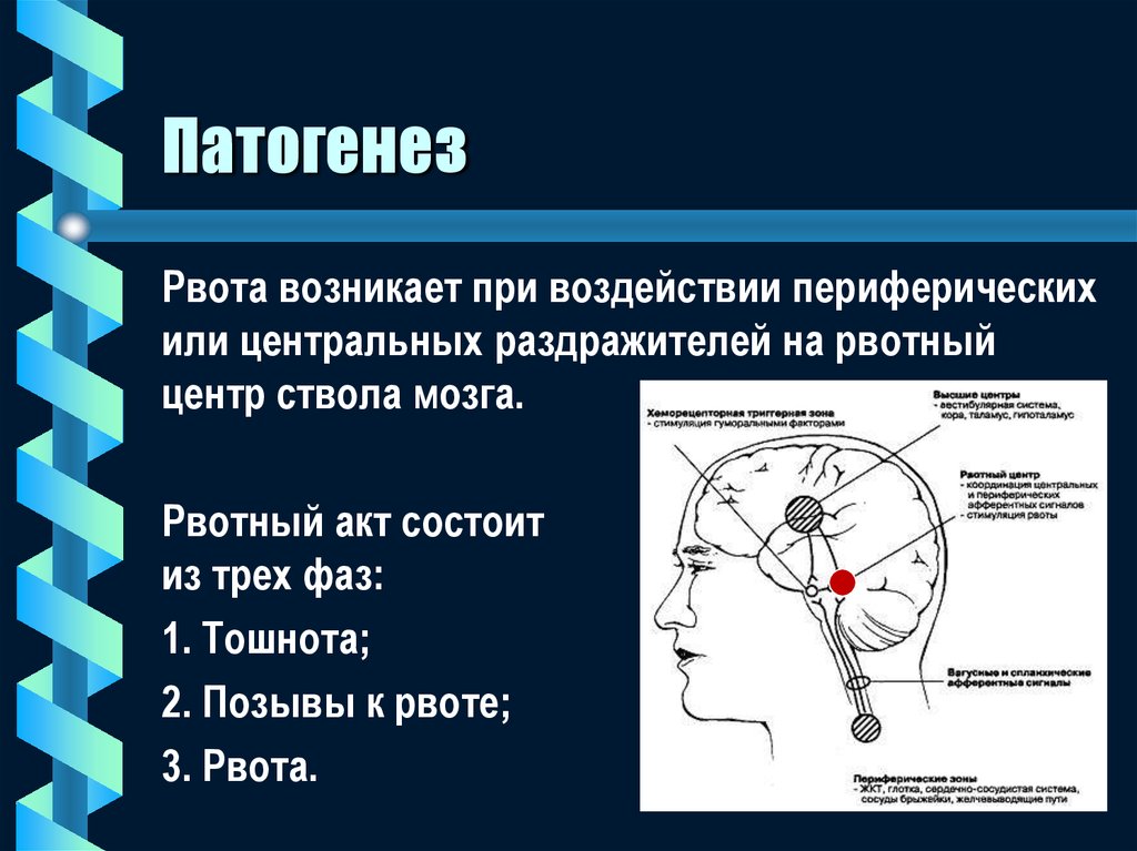 Рвотный рефлекс мозг. Механизм развития тошноты и рвоты. Патогенез рвоты. Патогенез тошноты. Механизм развития рвоты схема.