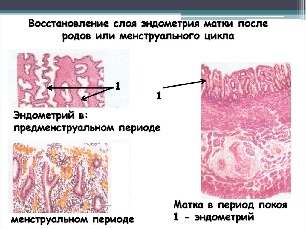 Восстановление эндометрия после