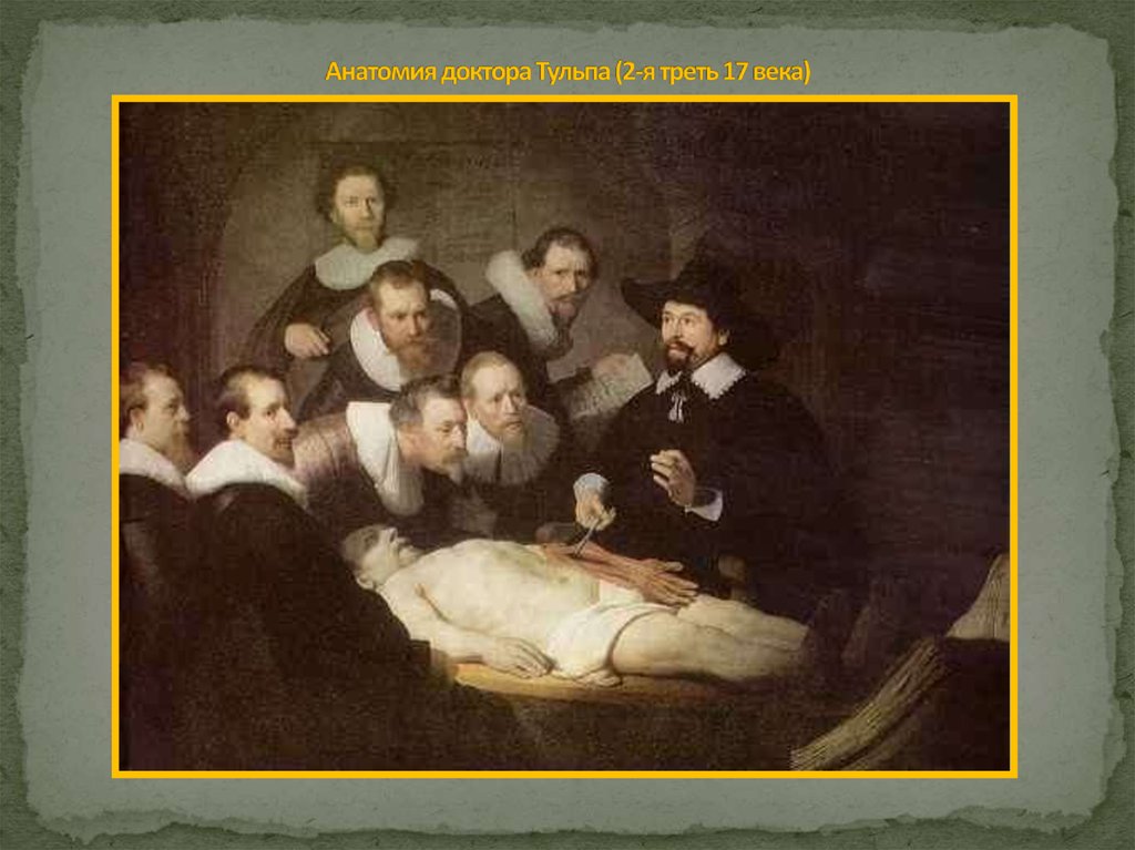 Анатомия доктора Тульпа (2-я треть 17 века)