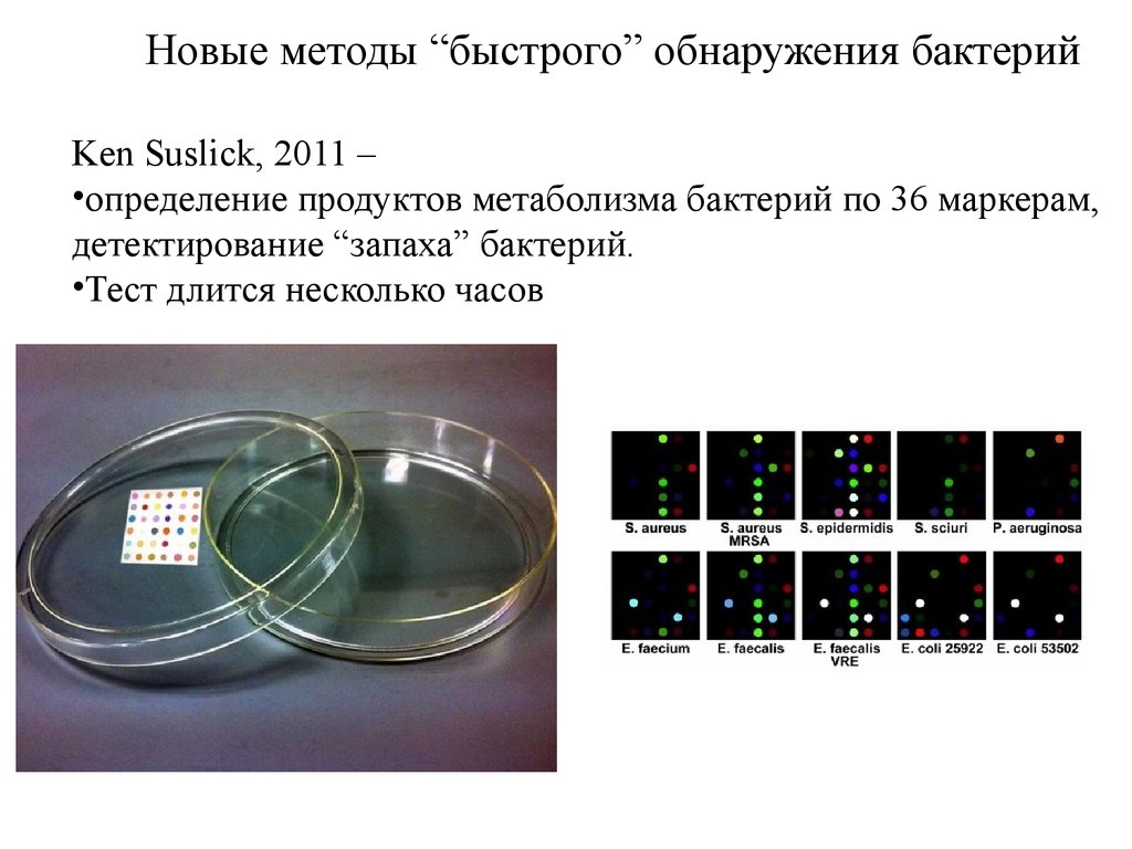 Методы быстрее. Методы обнаружения микроорганизмов. Обнаружение бактериальных средств. Ускоренные методы обнаружения бактериальных средств эпидемиология. Методов быстрой детекции.