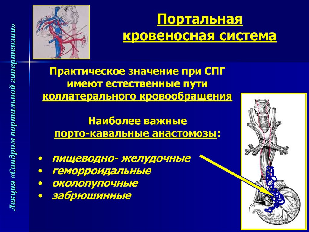 Синдром портальной гипертензии презентация