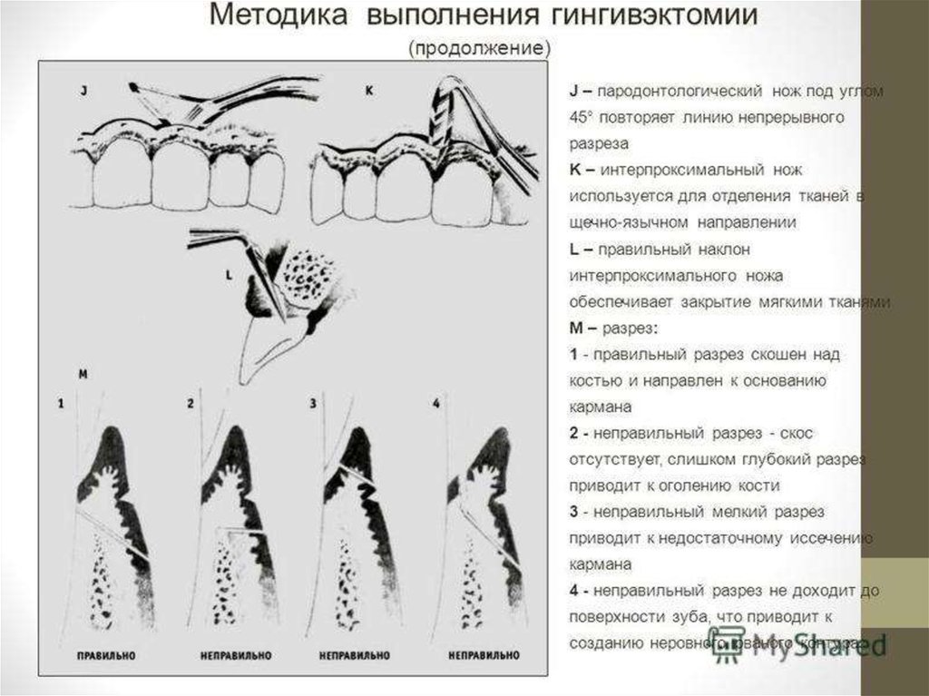 Карта исследования пародонта